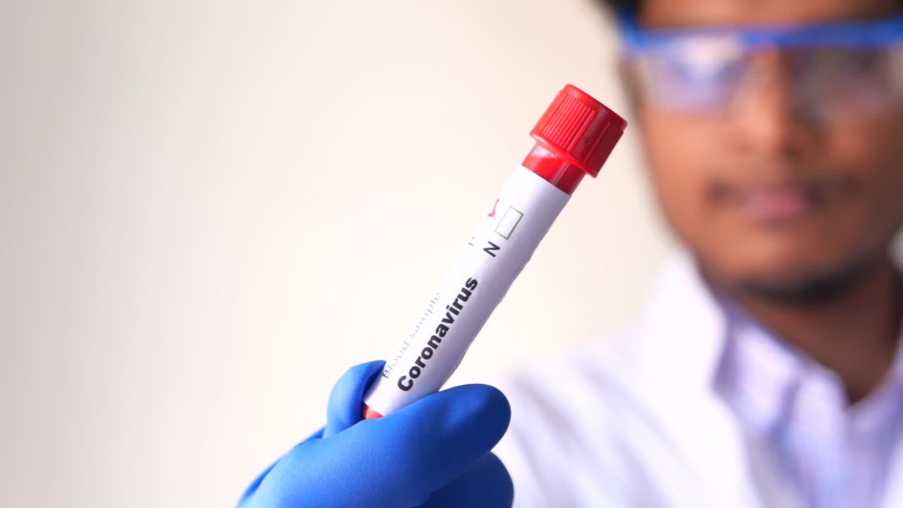 análisis de sangre para el coronavirus