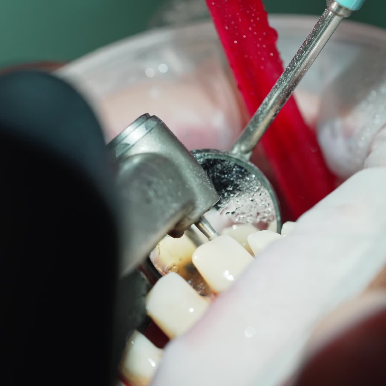 Dental treatment at the dentist