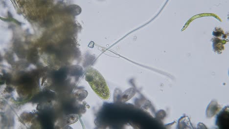 diferentes especies de agua dulce de protozoos organismos unicelulares como estentores, ciliados y movimiento de algas bajo el microscopio vista archivada brillante