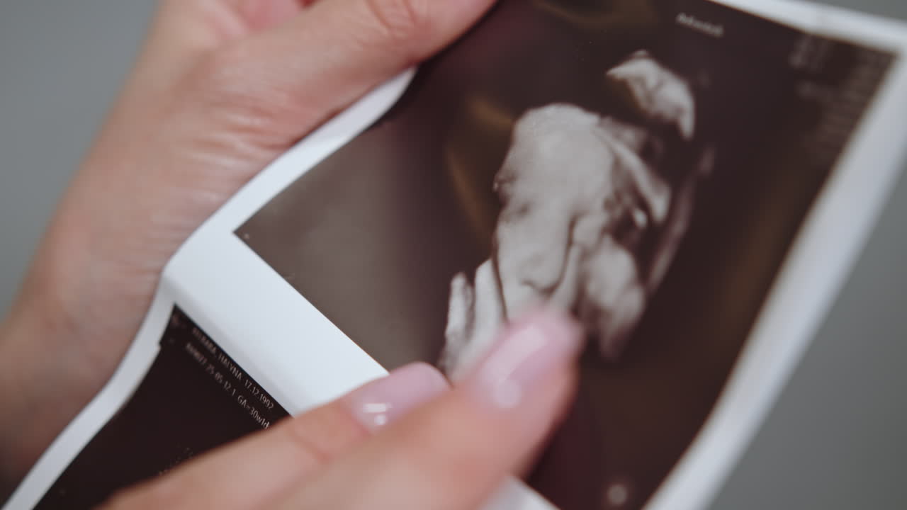 Primo piano delle mani di una donna che tengono e indicano un'immagine ecografica 3D che mostra il volto di un bambino