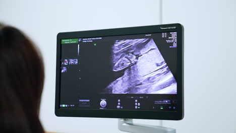 image of intrauterine development of the baby. ultrasound machine monitor in doctor's cabinet.