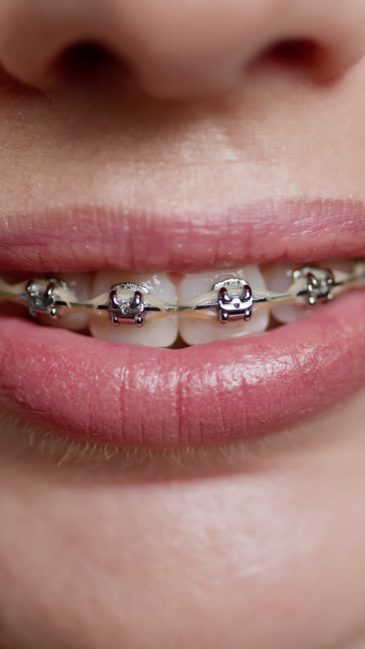 Woman with braces