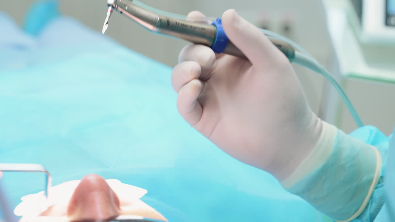 VINNYTSIA, UKRAINE - MAY 20, 2023: Hands of dentist in sterile gloves change drill bit in the drill machine. Close-up