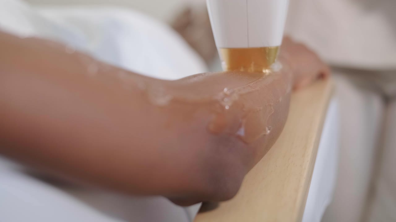 depilación con láser y cosmetología en salones de belleza. cosmetología, spa y concepto de depilación. procedimiento de depilación láser de las piernas femeninas. médico en guantes.