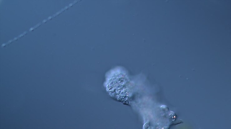 Microscopic Amoeba Movement and Shape Change