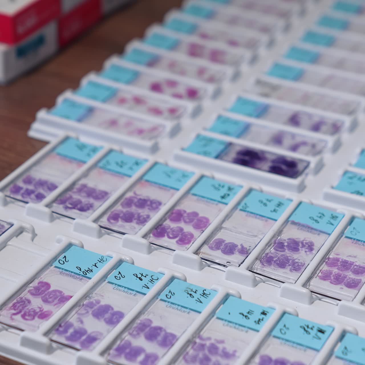 Vacuum for collecting in the lab. Procedure for the collection of samples in lab