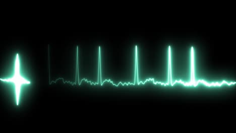 ecg en pacientes con fibrilación auricular.