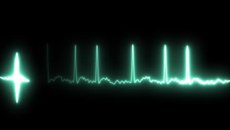 ecg in patients with atrial fibrillation.