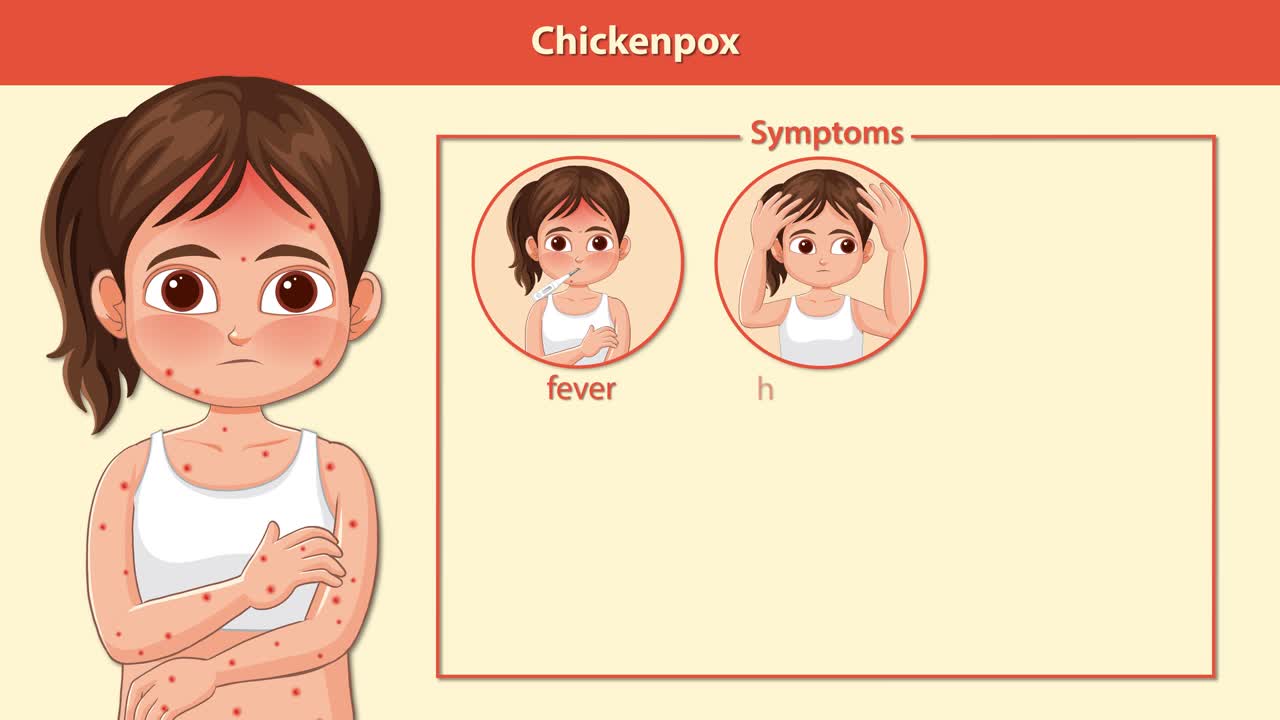 Cartoon animation explains chickenpox symptoms in children using labeled icons and smooth transitions