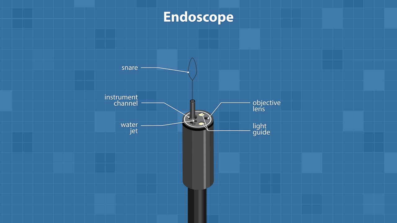 Labeled animation reveals endoscope tip parts, including snare, channels, and nozzles, on blue background