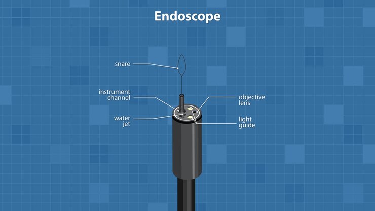 Labeled animation reveals endoscope tip parts, including snare, channels, and nozzles, on blue background