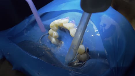 enjuague con agua y succión durante la limpieza dental