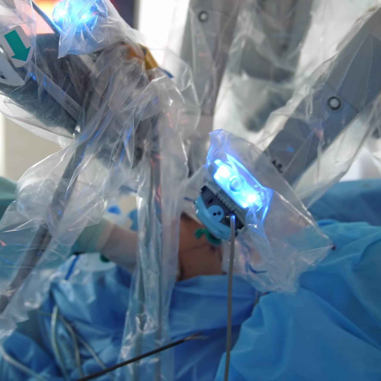 Microsurgery with robotic device. Doctor performs operation using surgical equipment. Modern machine robot doing surgery in clinic