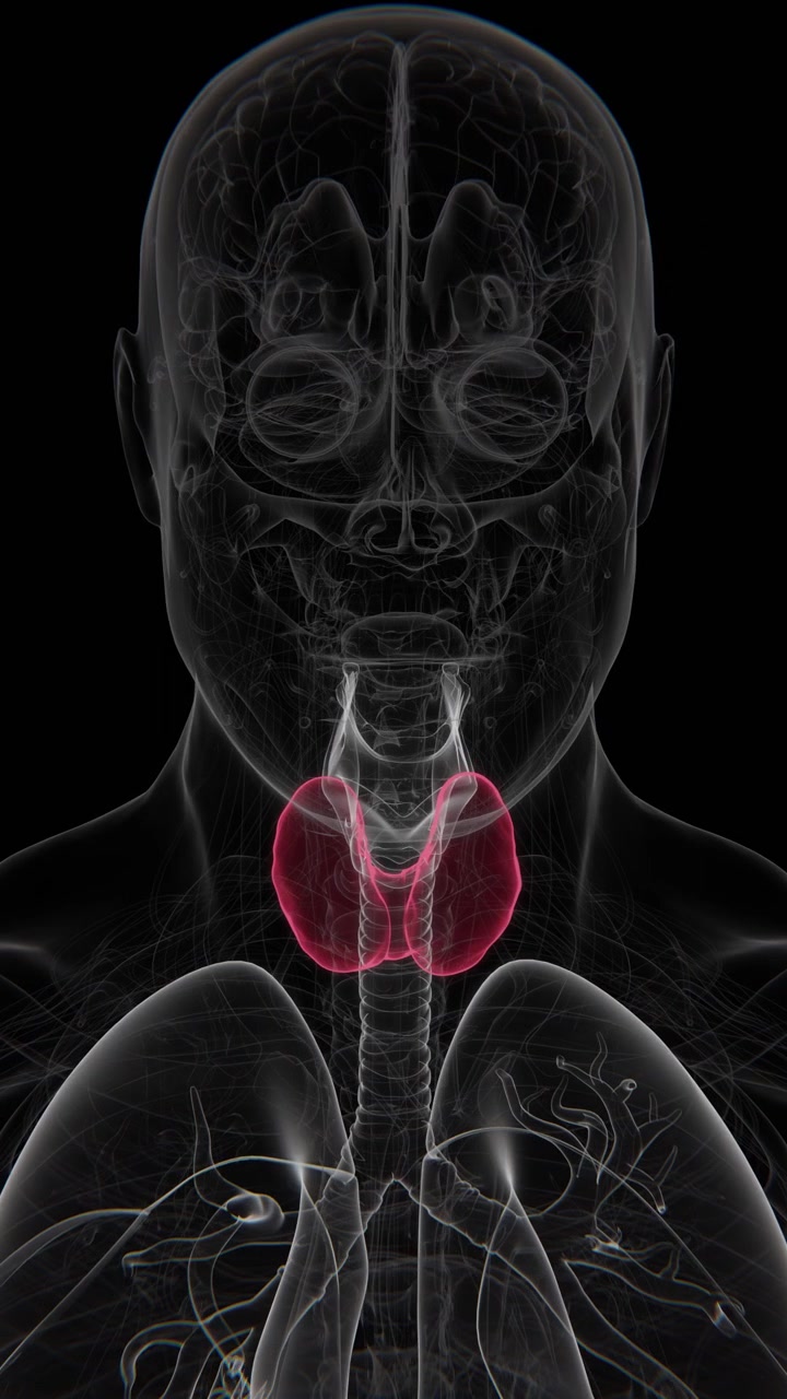 La tiroidite di Hashimoto è una malattia autoimmune in cui il sistema immunitario attacca la ghiandola tiroidea, causando spesso infiammazione cronica e ridotta produzione di ormoni tiroidei in 4K UHD