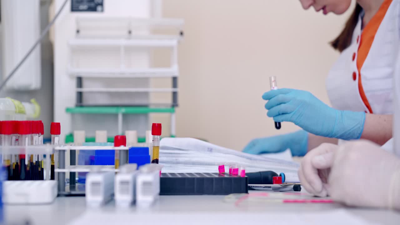 Medical lab researcher with blood sample. Doctor checks quality of centrifuged blood in collection tube