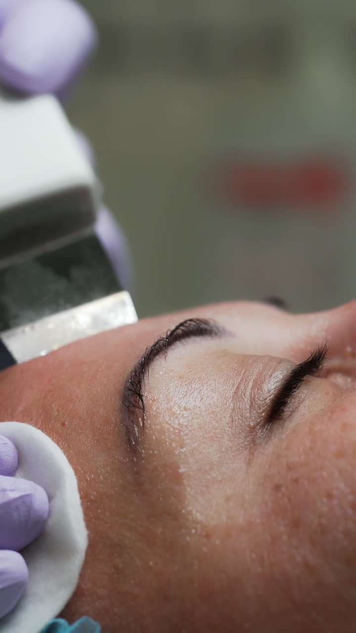 Ultrasonic face skin scrubber is moved by the female face. Cosmetologist holds the sponge in other hand using it to clean up. Close up. Vertical video