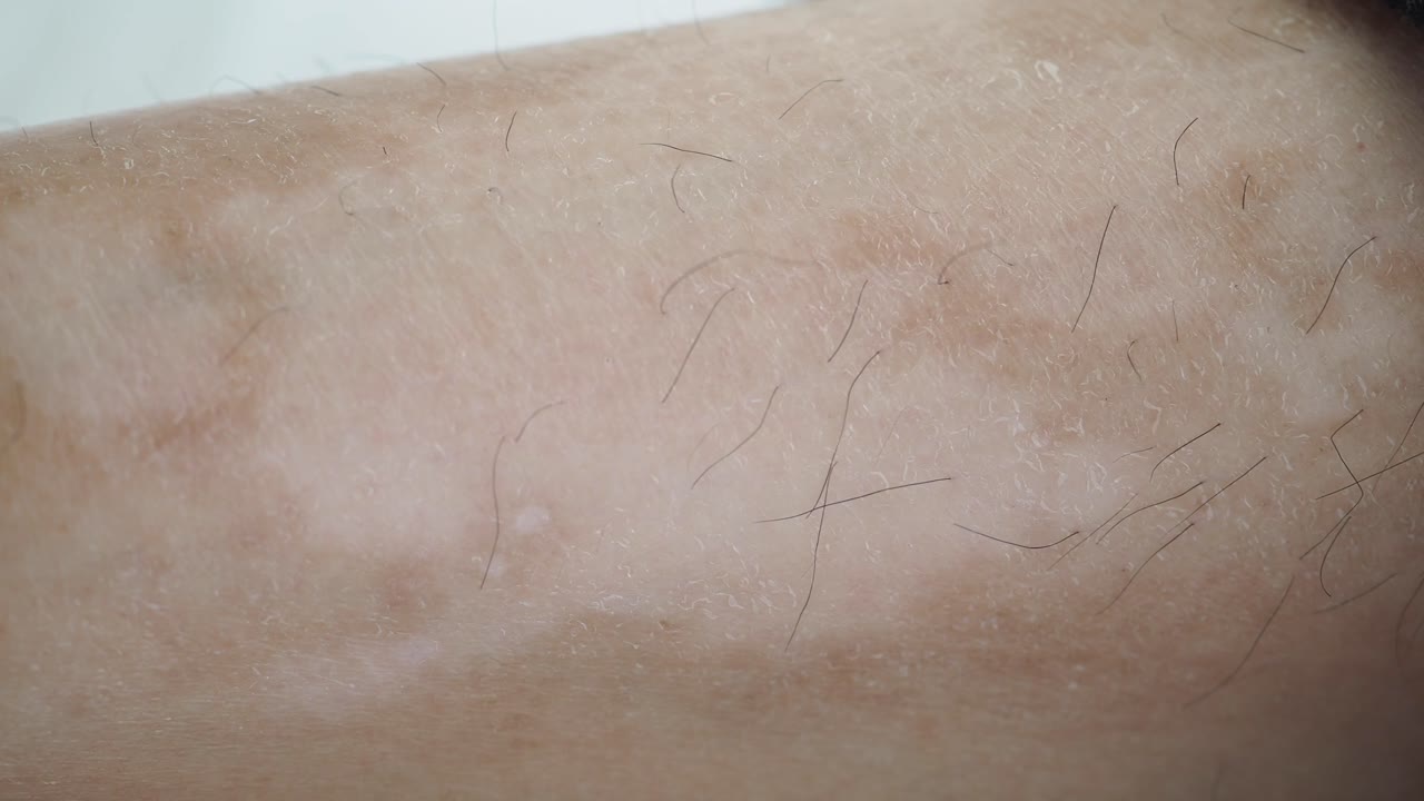 lesiones cutáneas en el brazo