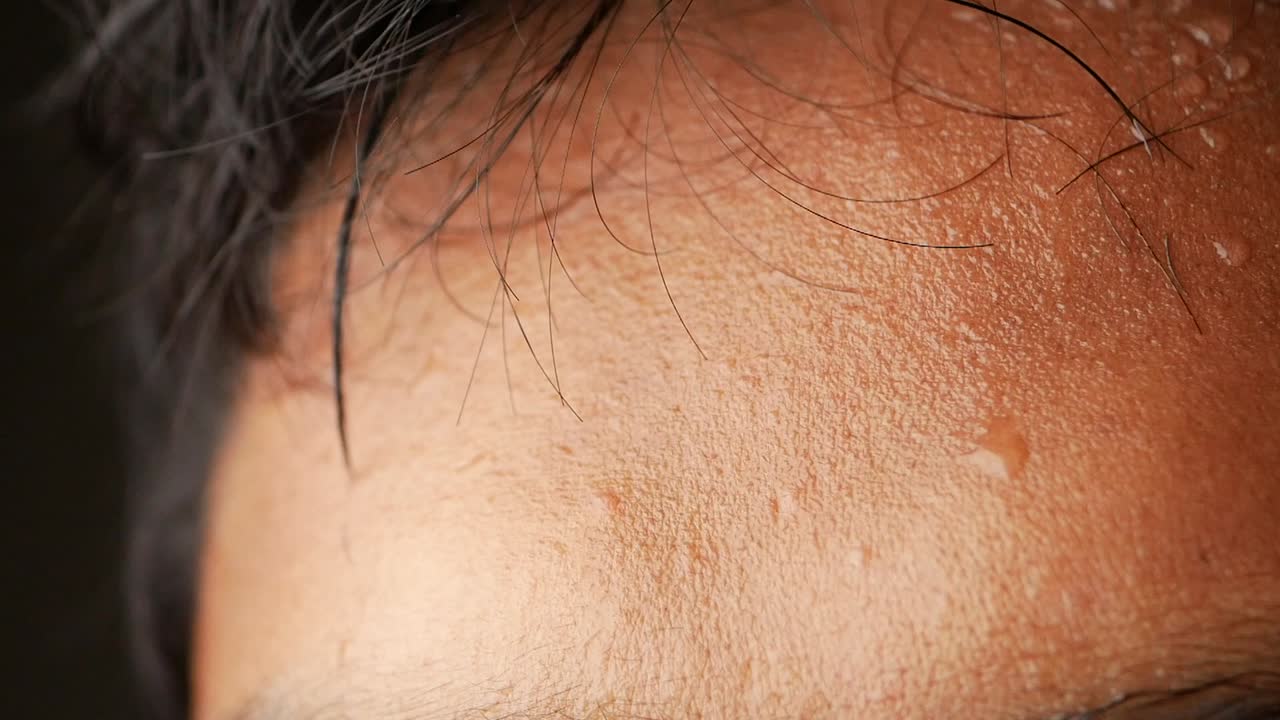 이 많은 이마의 클로즈업