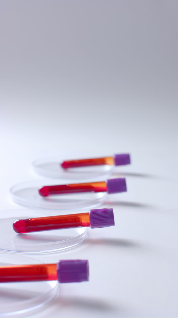 Vertical video of blood samples and petri dishes on white background with copy space, slow motion