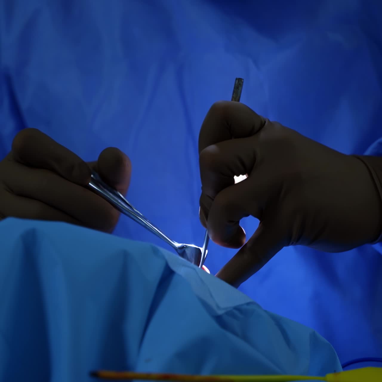 Doctor during surgery in operating room. Professional doctor performing operation in surgery room