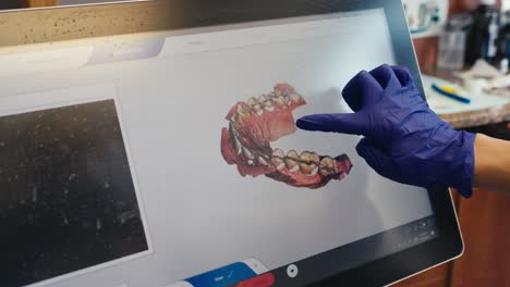 un dentista usando su dedo para mirar un escáner 3d de los dientes de un paciente en una tableta grande