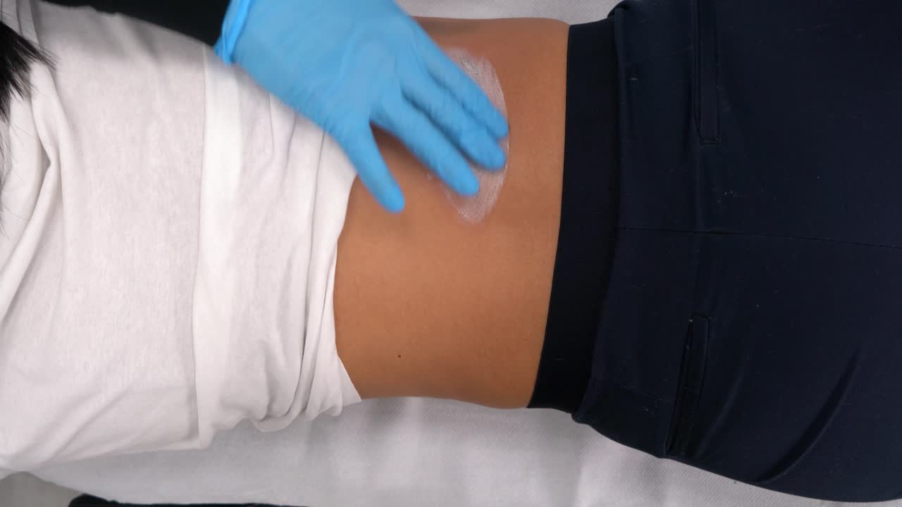 chica borrando tatuaje del nombre del ex novio, borrando o quitando