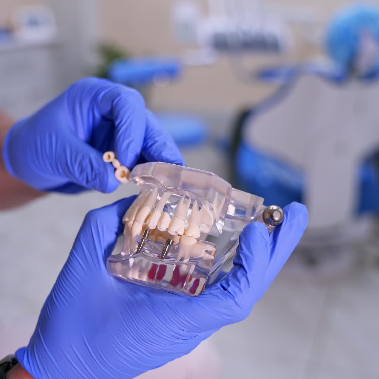 Jaw model in hands. Dentist showing on a jaw model how to put teeth where necessary. Medic in blue gloves. Close-up.