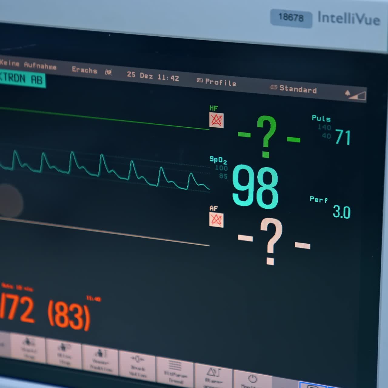 Heart beat rate ECG cardiac monitor. Heartbeat display. Electrocardiogram. Patient cardiac monitor in hospital. Cardiac monitoring