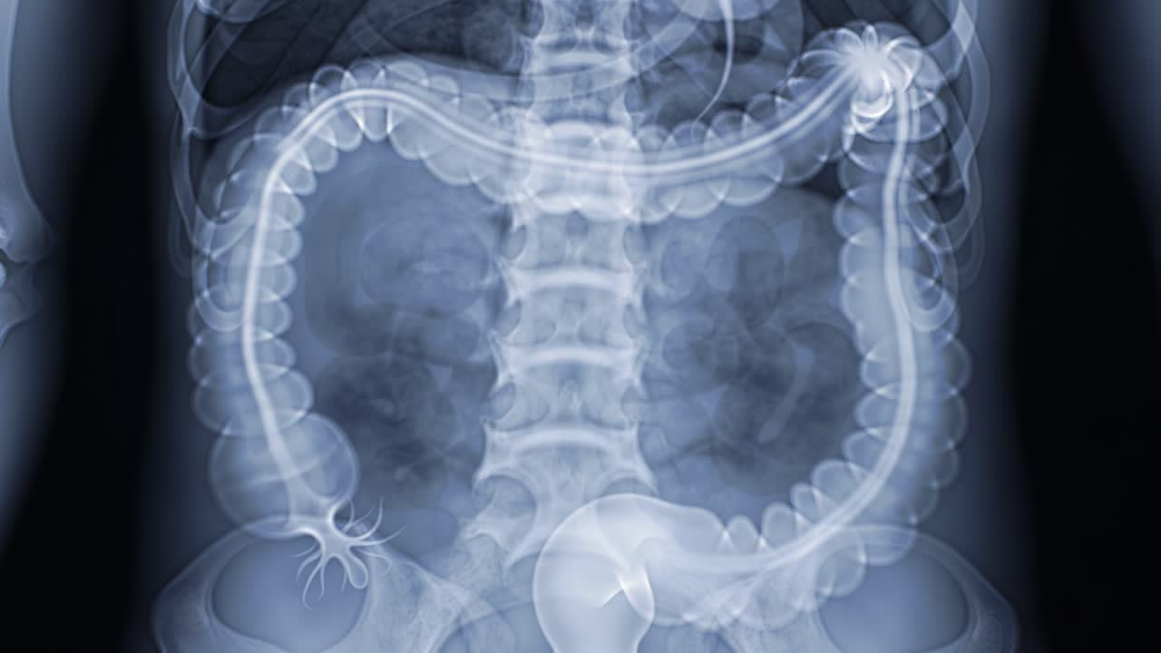 This presentation focuses on the digestive system, showcasing the complexities of human anatomy using x-ray imaging. It highlights the important roles various organs play in digestion.