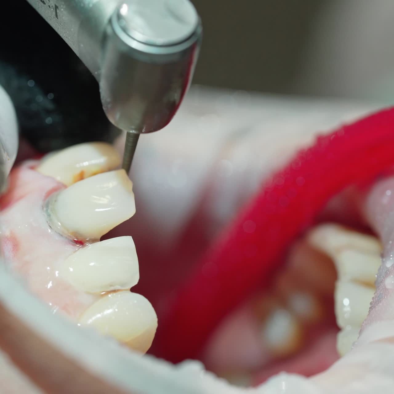 Dentist taking care of painful tooth