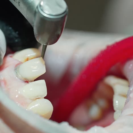 dentist taking care of painful tooth