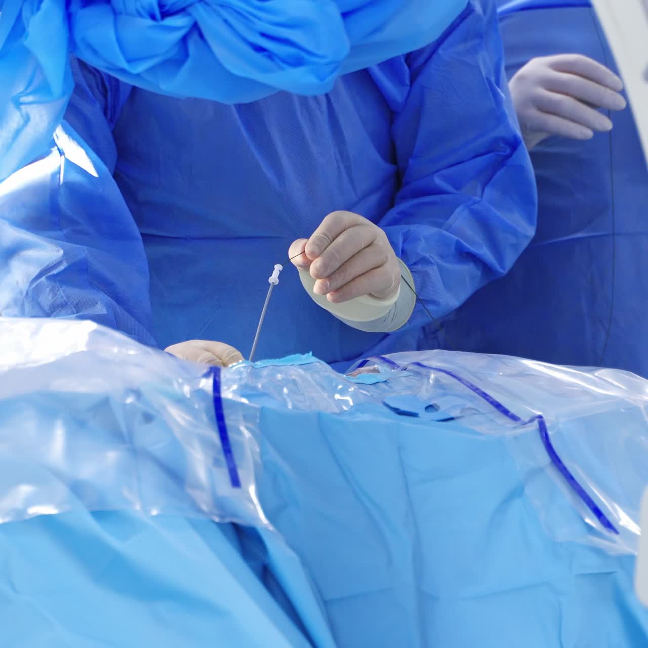 Modern surgery health treatment. Surgery with new medical instruments