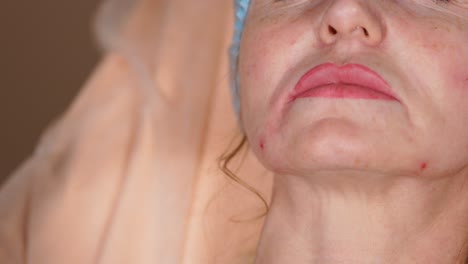 Cosmetic Procedure on a Woman's Face