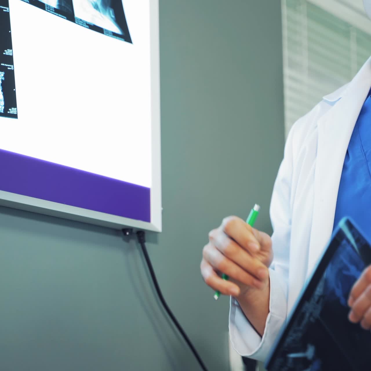 Doctor reviewing brain X rays