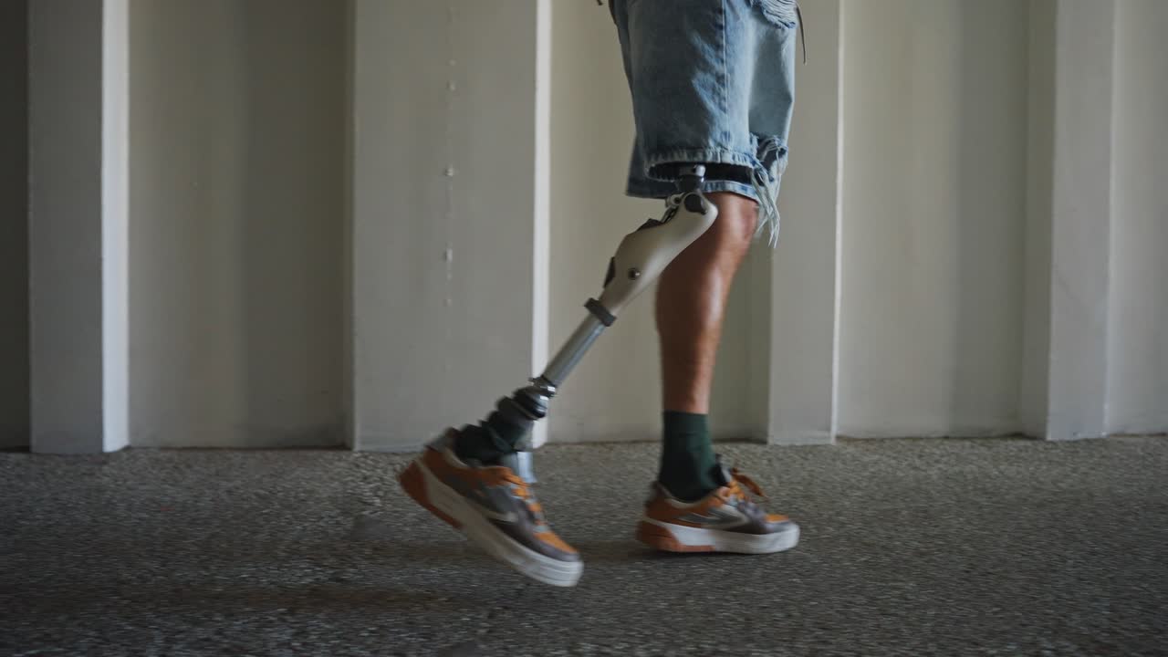 Person with Prosthetic Leg Walking