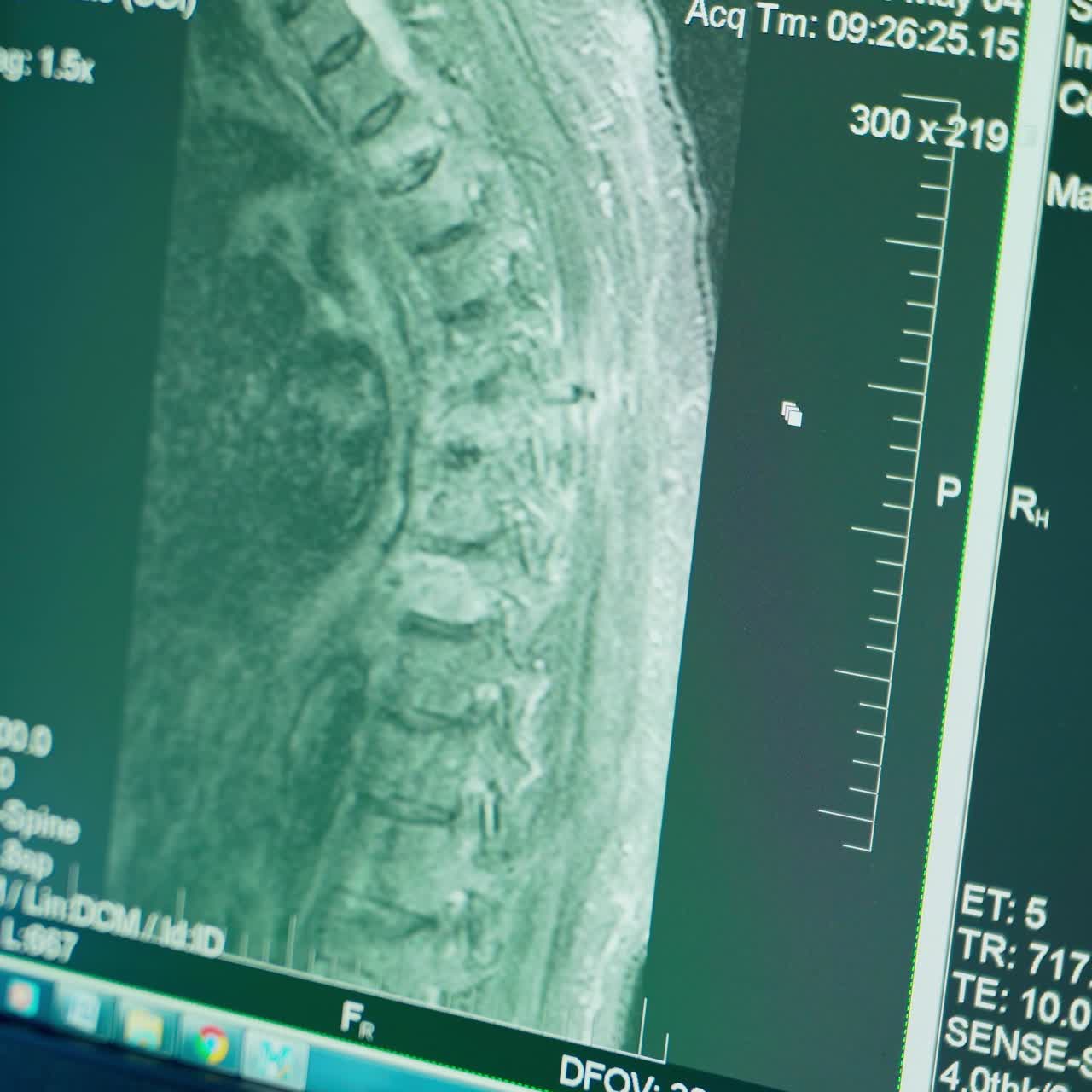 Radiological chest x-ray