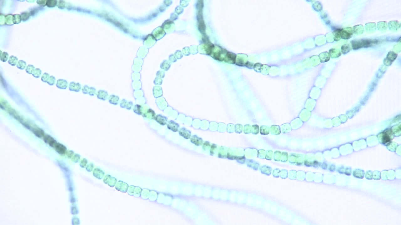vista microscópica de cadenas de algas