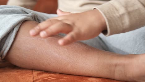 a child touches their leg with dry skin