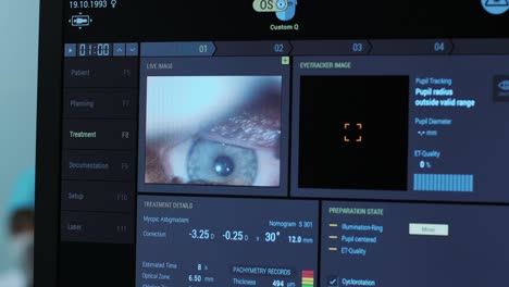 ophthalmic surgery. view on the screen of medical monitor in operating room. lasik