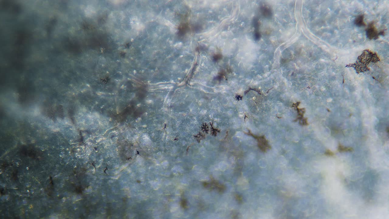 혈관 모세관 현미경의 혈액 적혈구 이동