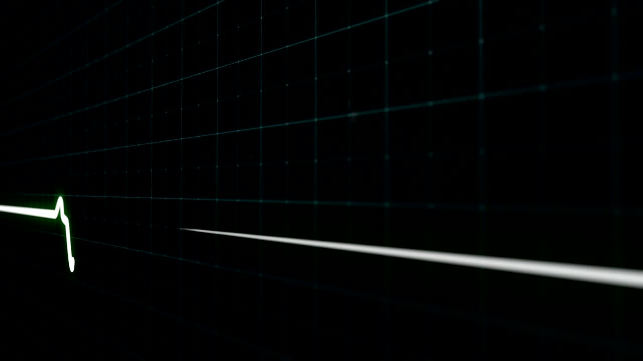 심장 카디오그램 차트 클로즈업