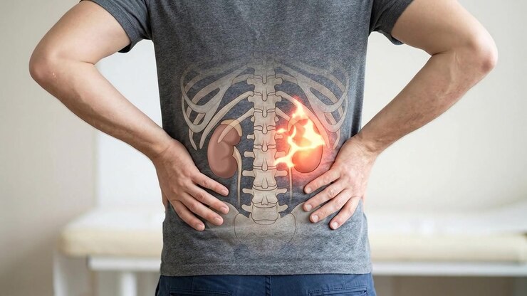 Man Experiencing Kidney Pain with Anatomical Overlay