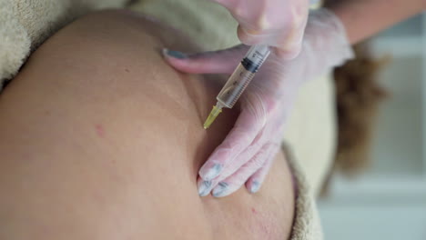 patient receiving mesotherapy treatment on the buttocks to reduce fat and cellulite