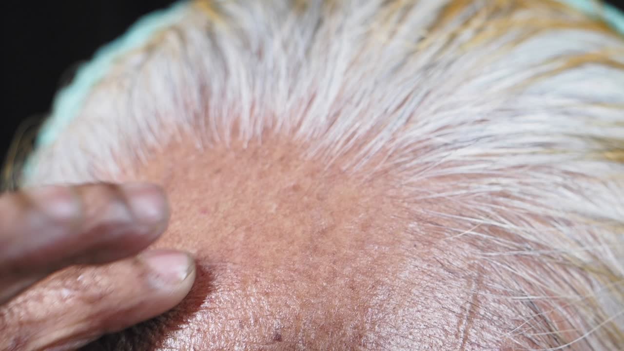 Close-up of a person's head with white hair and wrinkles.