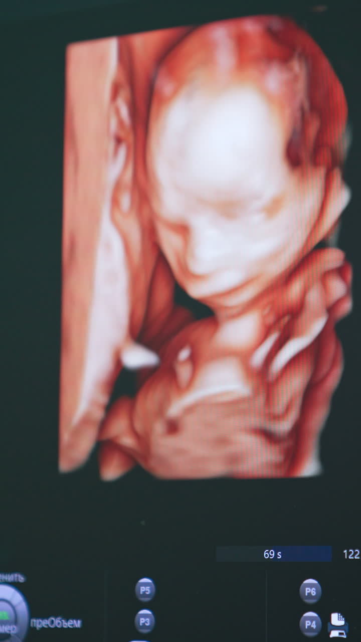 Ultrasonic image of a baby in mother's womb. Diagnostics of pregnancy at hospital. Close up.. Vertical video