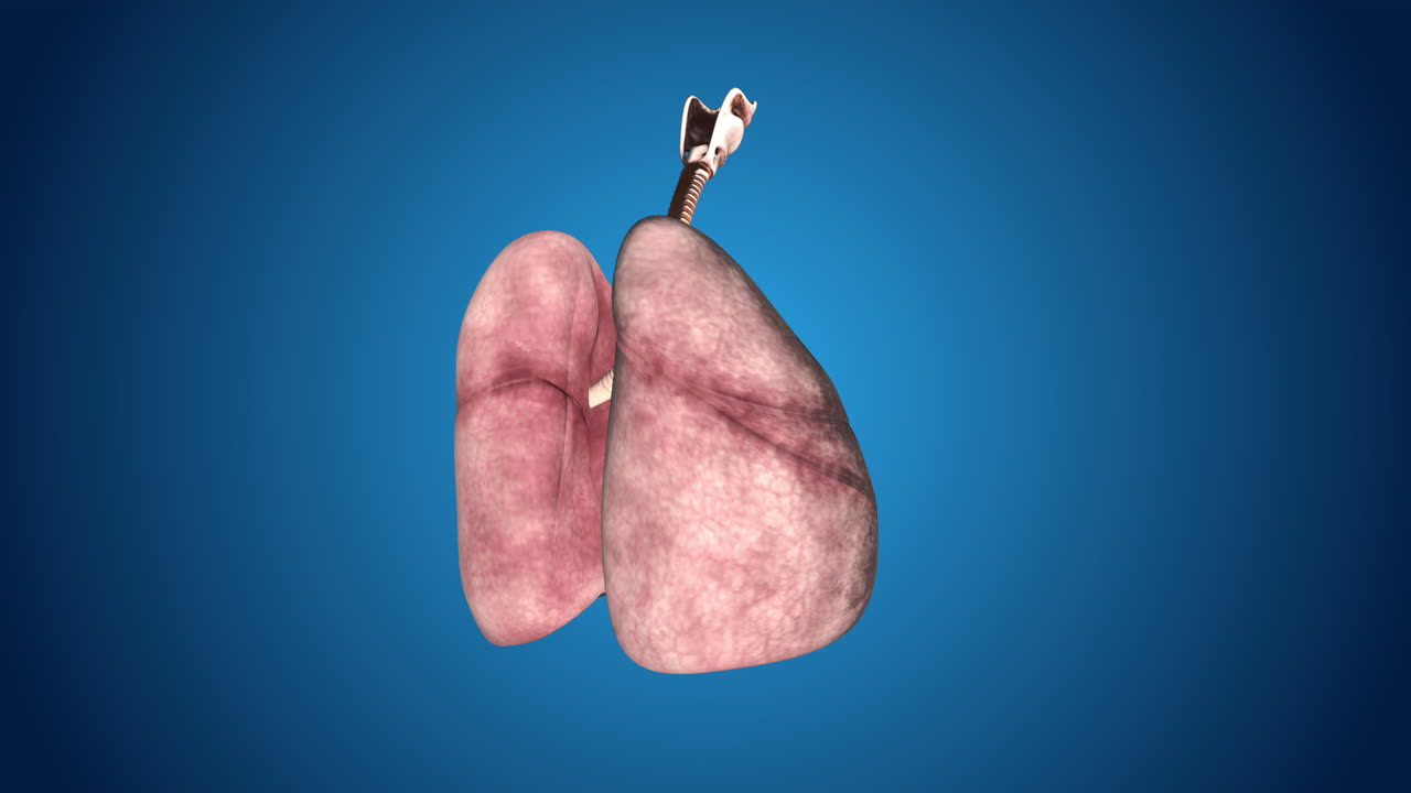 3D Model of Lungs and Trachea