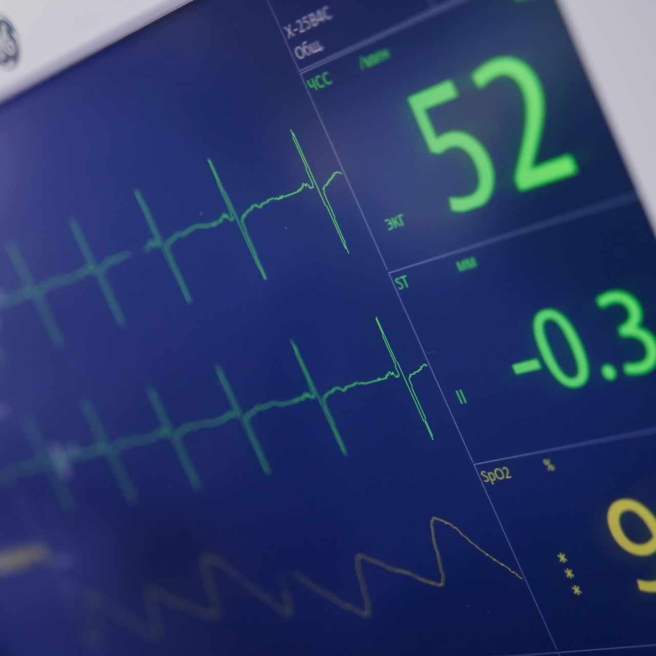Life parameters of operated patient. Close up. Monitor working in the surgery room during operation