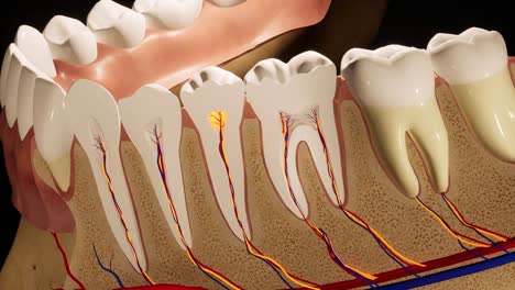 toothache. anatomical detailed section of the teeth. nerve inflammation. 3d animation