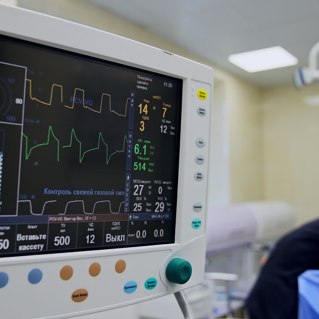 The screen of artificial lung ventilation apparatus working during surgery. Black monitor demonstration life signs of a patient under procedure. Doctors operating at backdrop