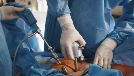 laparoscopic abdominal surgery